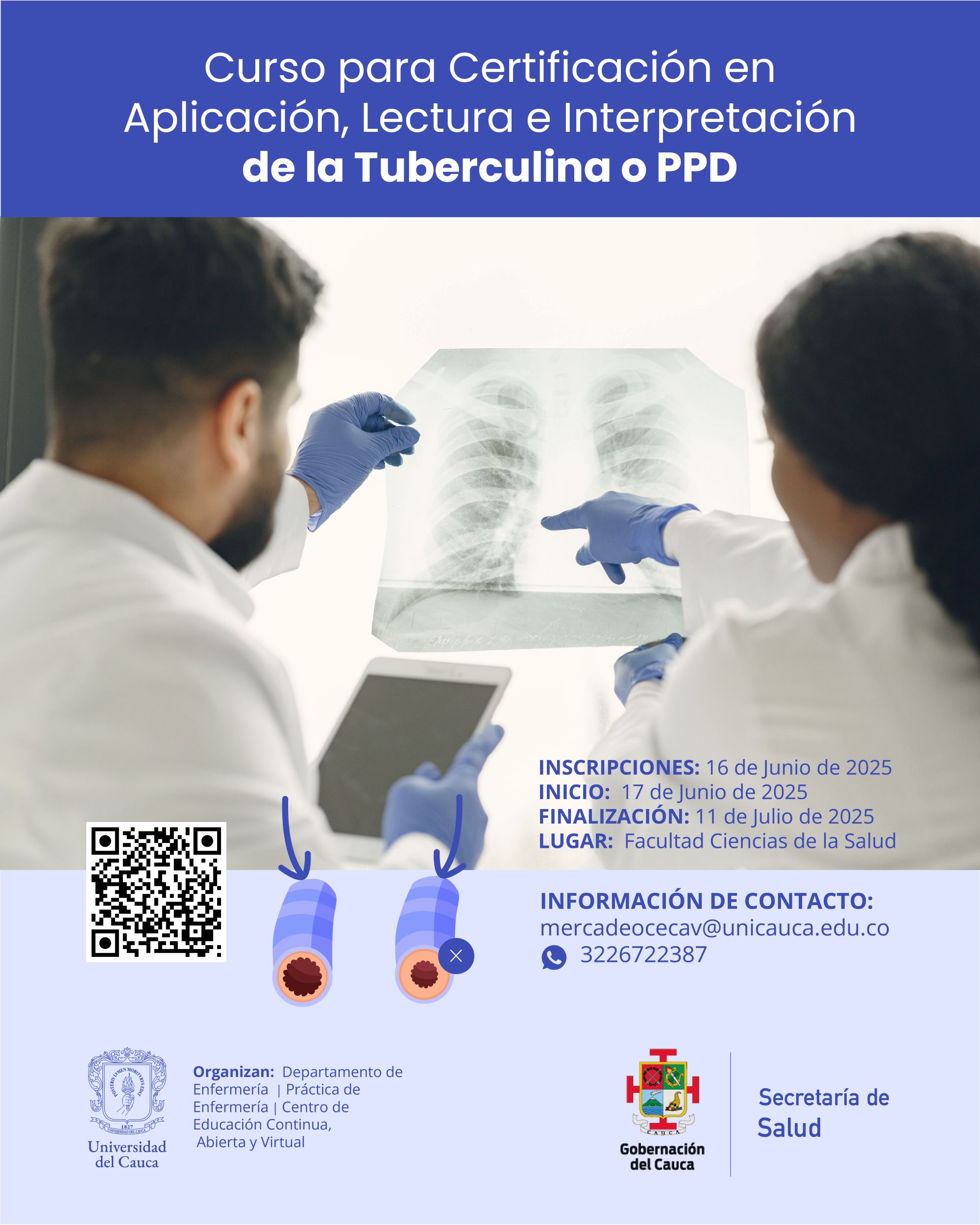 Curso para Certificación en Aplicación, Lectura e Interpretación de la Tuberculina o PPD, Dirigido a Profesionales de Salud y Auxiliares de Enfermería Actúen como Facilitadores de Aplicación y Lectora en los Programas de Tuberculosis Latente de los 42 Municipios del Departamento, 2025